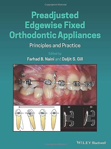 Preadjusted Edgewise Fixed Orthodontic Appliances: Principles and Practice von Wiley-Blackwell
